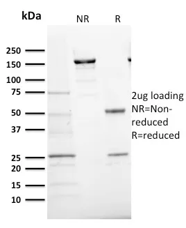 Anti-Ki-67 (Proliferating Cell Marker)(MKI67/2466) - image 6