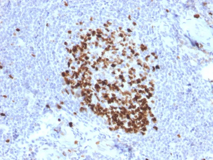 Anti-Ki-67 (Proliferating Cell Marker)(MKI67/2466) - image 1