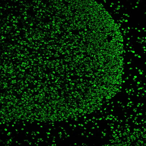 Anti-Ki-67 (Proliferating Cell Marker)(MKI67/2466) - image 3