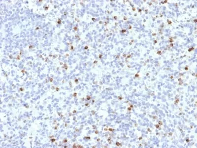 Anti-Perforin-1 (Pore Forming Protein) (Apoptosis Marker) (PRF1/2468) - image 1