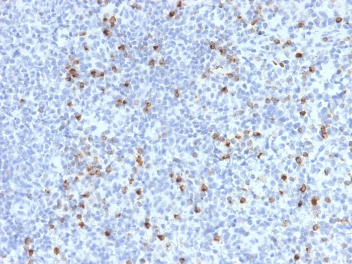 Anti-Perforin-1 (Pore Forming Protein) (Apoptosis Marker)(PRF1/2470) - image 1