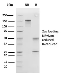 Anti-Peroxiredoxin 4 (Prognostic Marker for Lung SqCC)(CPTC-PRDX4-2), CF640R conjugate - image 1