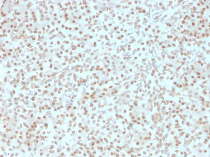 Anti-AKT1 (Prognostic Marker for Neuroendocrine Tumors)(AKT1/2491) - image 1