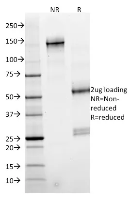 Anti-SMAD4 (Pancreatic Adenocarcinoma Marker)(SMAD4/2524) - image 1