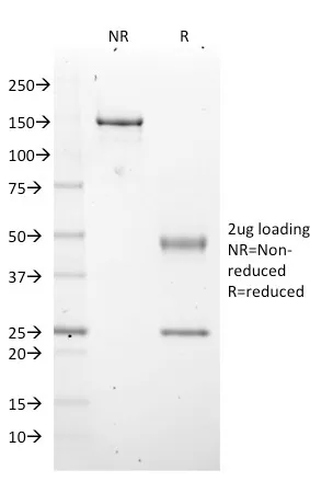 Anti-EZH2 / KMT6(EZH2/2536), CF594 conjugate - image 1