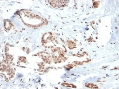 Anti-SOX4 (Master Regulator of Epithelial-Mesenchymal Transition) (SOX4/2540) - image 2