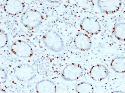 Anti-SOX4 (Master Regulator of Epithelial-Mesenchymal Transition) (SOX4/2540) - image 1