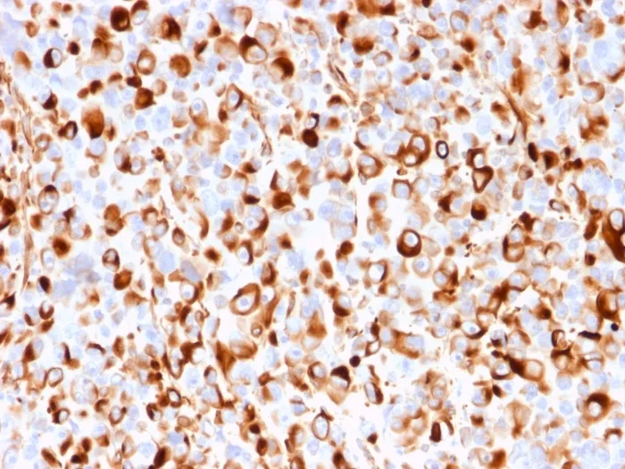 Anti-NGF-Receptor (p75) / CD271 (Soft Tissue Tumor Marker)(rNGFR/1965), CF594 conjugate - image 1