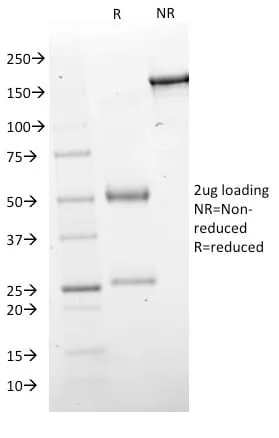 Anti-GAD1 / GAD67 (GABAergic Neuronal Marker) (GAD1/2563) - image 2