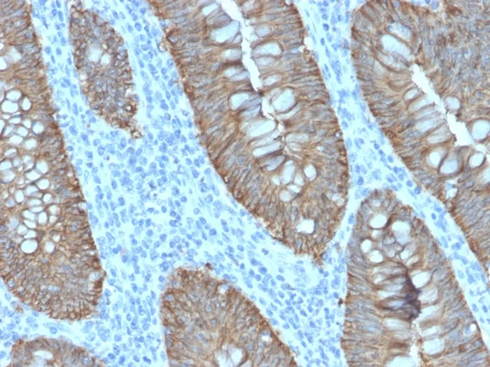 Anti-Ep-CAM / CD326 (Extracellular Domain) (Epithelial Marker)(EGP40/2571R) - image 1