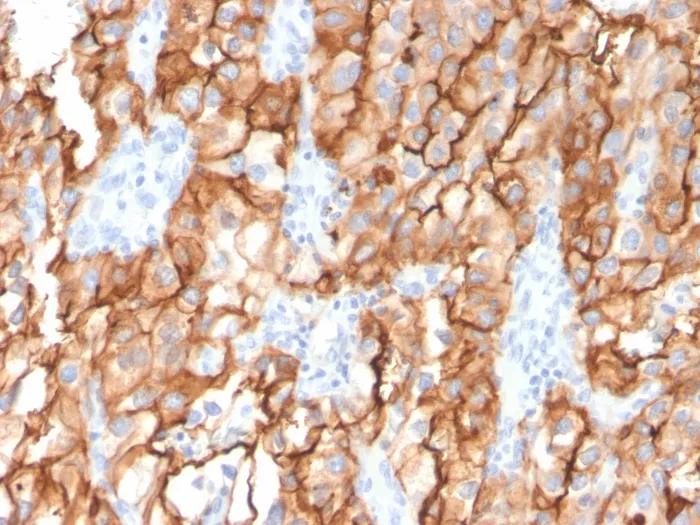 Anti-CD10 (Membrane Metalloendopeptidase)(MME/2579) - image 1