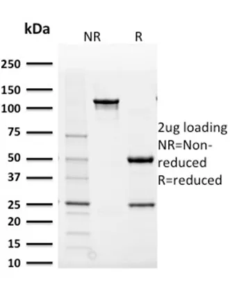 Anti-Aldo-keto Reductase Family 1 Member B1 (Adrenal Marker)(CPTC-AKR1B1-2), CF568 conjugate - image 1