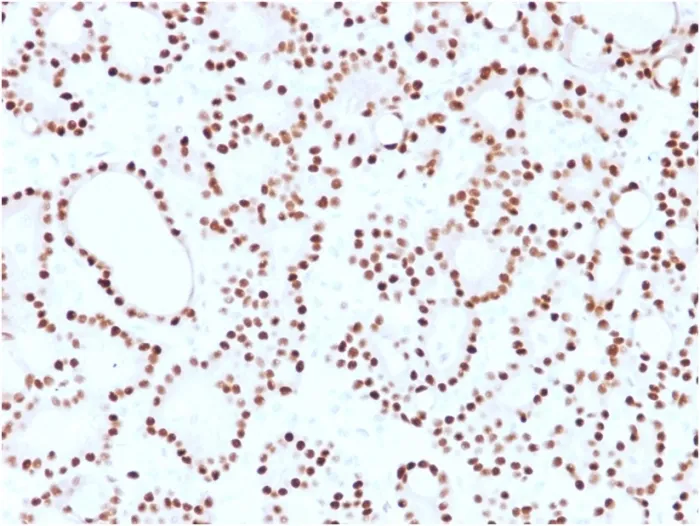 Anti-Cyclin D1 (G1-Cyclin & Mantle Cell Lymphoma Marker)(CCND1/2593), CF594 conjugate - image 1