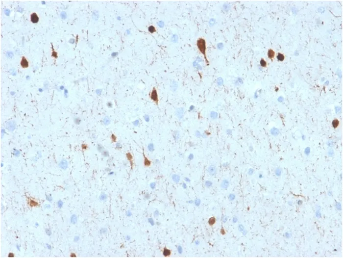 Anti-Calretinin / Calbindin 2 (Mesothelioma Marker)(CALB2/2602) - image 1