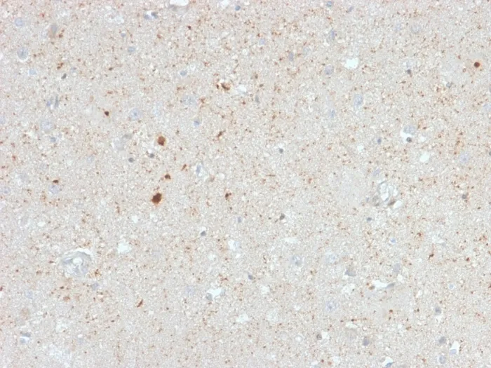 Anti-Calretinin / Calbindin 2 (Mesothelioma Marker)(CALB2/2603) - image 1