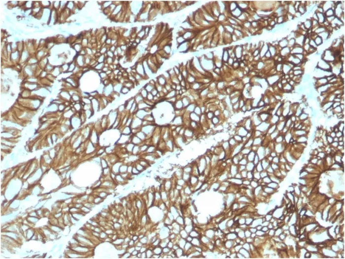 Anti-Cadherin 17 / LI Cadherin (Liver-Intestine Marker)(CDH17/2615) - image 1