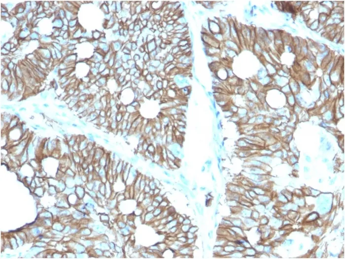 Anti-Cadherin 17 / LI Cadherin (Liver-Intestine Marker)(CDH17/2616), CF594 conjugate - image 1