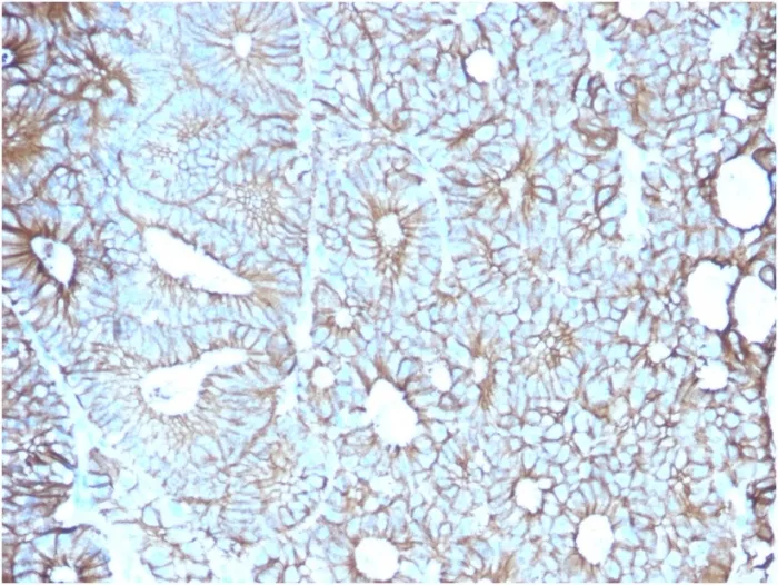 Anti-Cadherin 17 / LI Cadherin (Liver-Intestine Marker)(CDH17/2617), CF488A conjugate - image 1