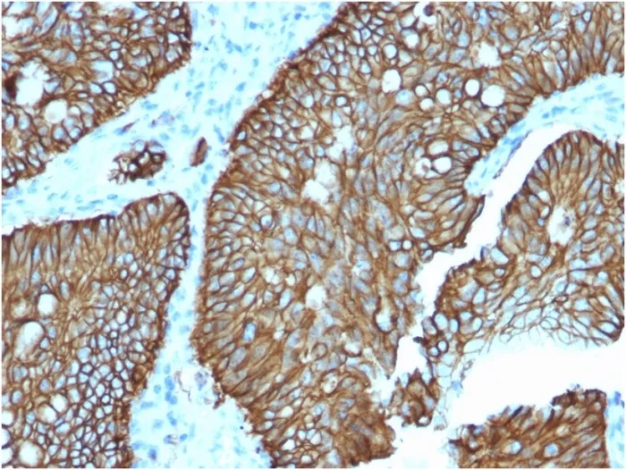 Anti-Cadherin 17 / LI Cadherin (Liver-Intestine Marker)(CDH17/2618), CF647 conjugate - image 1