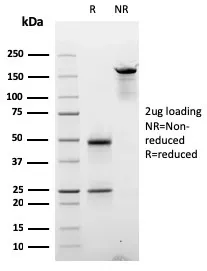 Anti-Cyclin D2(CCND2/2620) - image 1