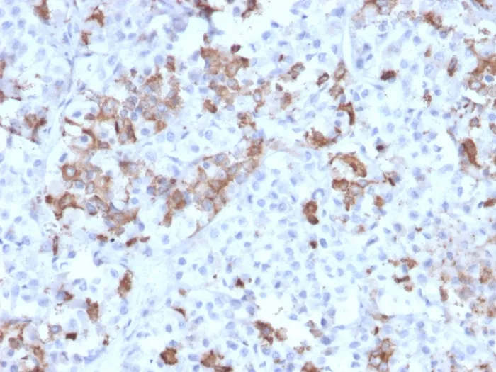 Anti-Prolactin (Pituitary Tumor Marker)(PRL/2642), CF568 conjugate - image 1