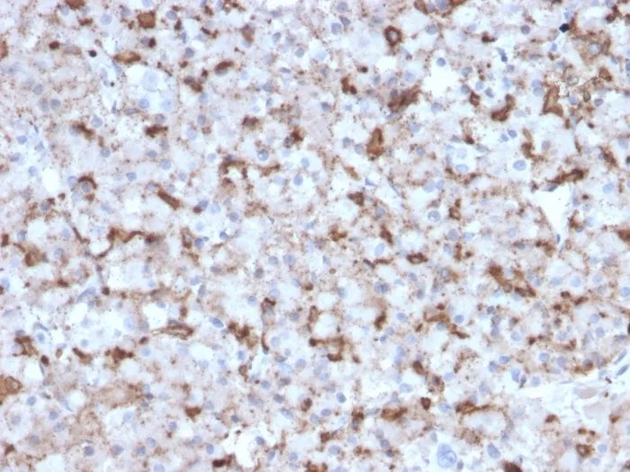 Anti-Prolactin (Pituitary Tumor Marker)(PRL/2643) - image 1
