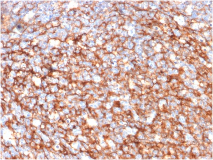 Anti-CD73 (Immuno-Oncology Target)(NT5E/2646) - image 1