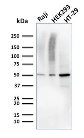 Anti-MMP3 (Marker of Metastasis and Rheumatoid Arthritis)(MMP3/2655) - image 1