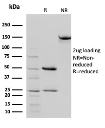 Anti-STAT5B(STAT5B/2657) - image 1