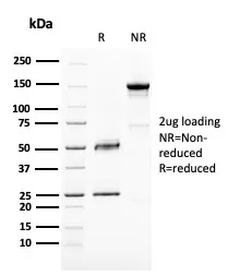 Anti-BAP1 (BRCA1 Associated Protein 1)(BAP1/2667) - image 1