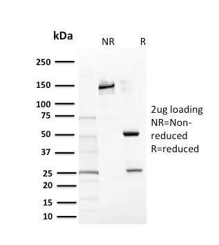 Anti-CD117 / c-Kit (Marker for Gastrointestinal Stromal Tumors)(KIT/2669) - image 1