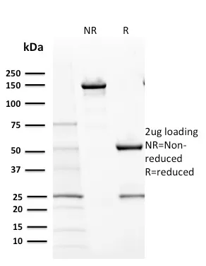 Anti-CD117 / c-Kit (Marker for Gastrointestinal Stromal Tumors)(KIT/2670) - image 1