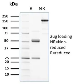 Anti-CD117 / c-Kit (Marker for Gastrointestinal Stromal Tumors)(KIT/2672) - image 1