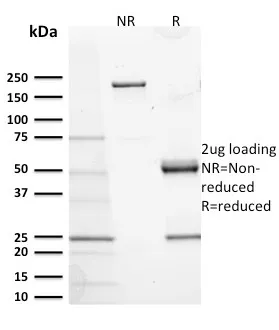 Anti-CD117 / c-Kit (Marker for Gastrointestinal Stromal Tumors)(KIT/2673) - image 1