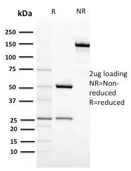 Anti-CD117 / c-Kit (Marker for Gastrointestinal Stromal Tumors)(KIT/2674) - image 1