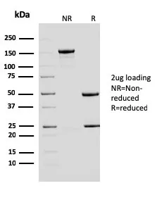 Anti-ERCC1 / RAD10 (Tumor Progression Marker)(ERCC1/2683), CF594 conjugate - image 1
