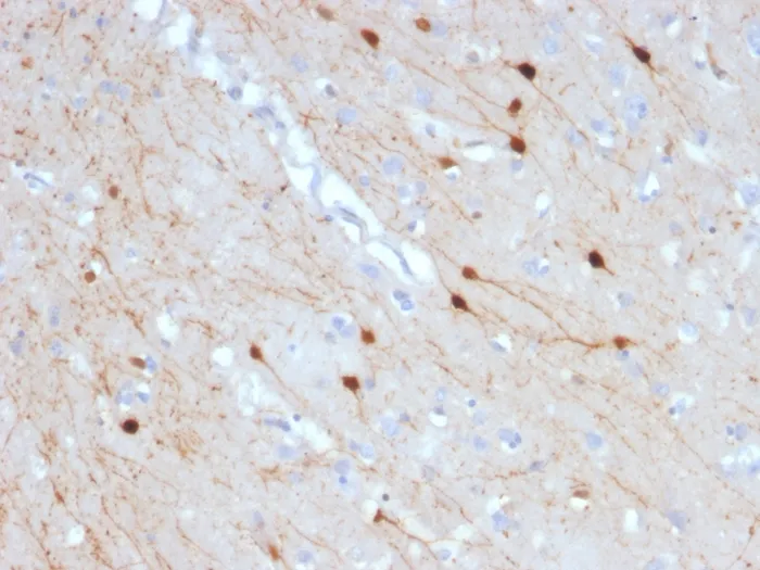 Anti-Calretinin / Calbindin 2 (Mesothelioma Marker)(CALB2/2685) - image 1