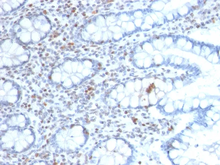 Anti-BMI1 (Oncogene and Stem Cell Marker)(BMI1/2689) - image 1