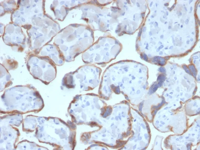 Anti-PAPP-A / Pappalysin-1 (Marker of Atherosclerosis and Aneuploid Fetus)(PAPPA/2716) - image 1