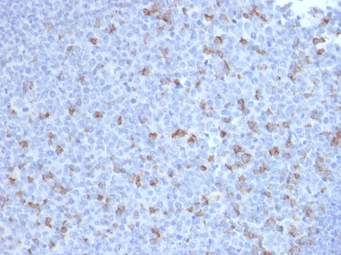 Anti-PDCD1 / PD1 / CD279 (Programmed Cell Death 1)(PDCD1/2720) - image 1
