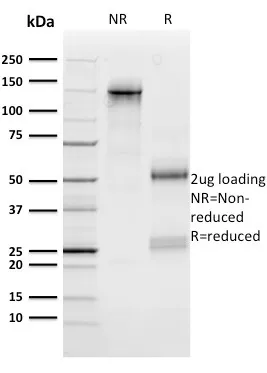 Anti-n-Myc (Neuroblastoma Marker)(NMYC-1) - image 1
