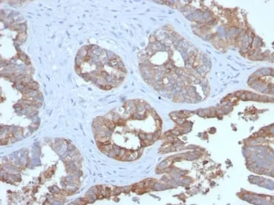 Anti-MUC1 / CA15-3 / EMA / CD227 (Epithelial Marker) (MUC1/2729R) - image 1