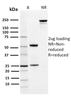 Anti-PD-L1 / PDCD1LG1 / CD274 / B7-H1 (Cancer Immunotherapy Target)(PDL1/2742), Biotin conjugate - image 1