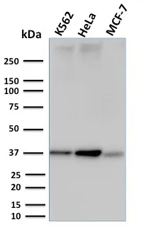 Anti-RAD51 (Prognostic and Response to Chemotherapy Marker)(RAD51/2753) - image 1