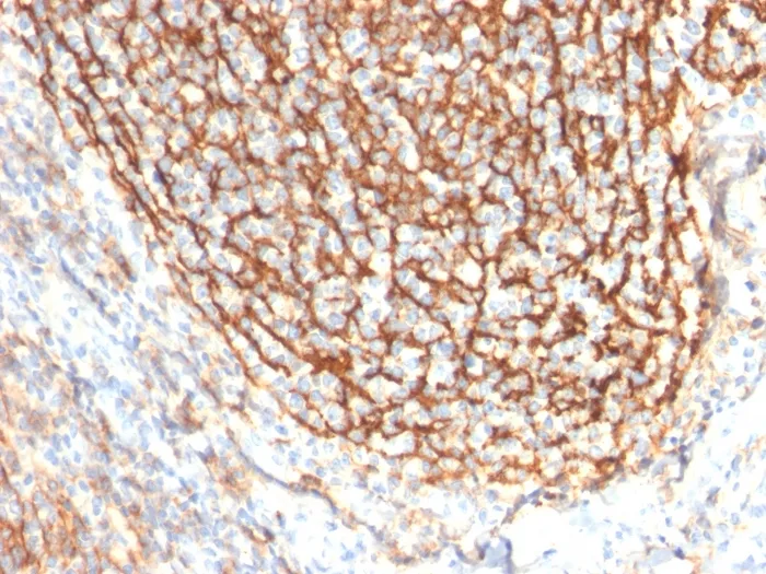 Anti-CD21 (Mature B-Cell & Follicular Dendritic Cell Marker)(CR2/2754) - image 1