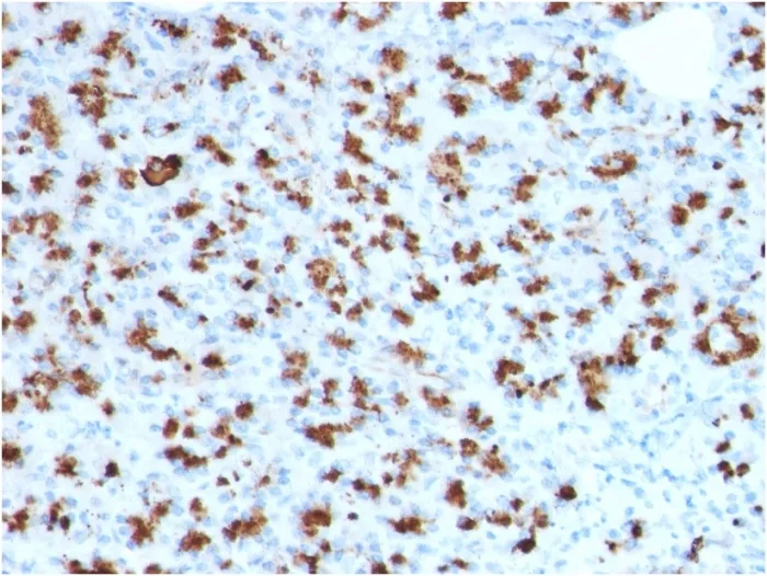 Anti-BARX1 (Prognostic Biomarker in Hepatocellular Carcinoma)(BARX1/2760), CF568 conjugate - image 1
