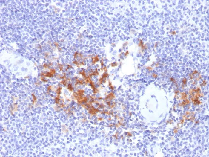 Anti-TRAF1 (TNFR-Associated Factor 1) (Lymphomatoid Papulosis Marker)(TRAF1/2770), Biotin conjugate - image 1