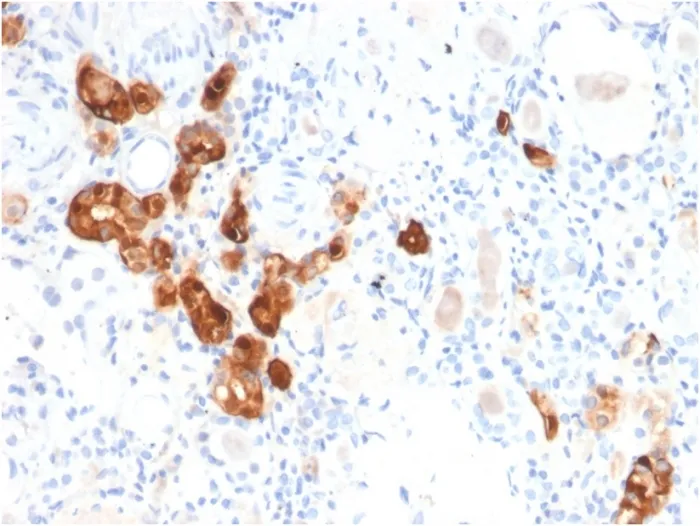 Anti-Calbindin 1 (CALB1)(CALB1/2782), CF594 conjugate - image 1