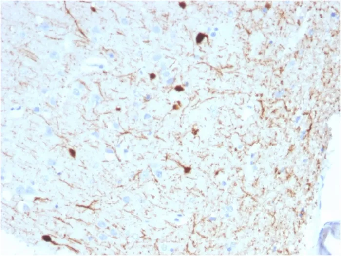 Anti-Calretinin / Calbindin 2 (Mesothelioma Marker)(CALB2/2786) - image 1