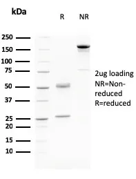 Anti-Desmoglein-3 (Squamous Cell Marker)(DSG3/2796) - image 1